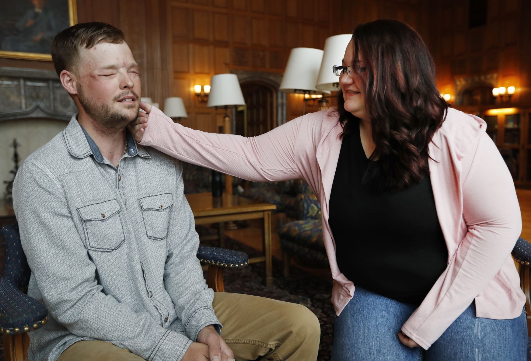 Tearful meeting for pair forever linked by face transplant